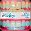 Продам: Отбеливающие полоски crest 3D white whitestrips Vivid